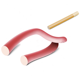 医学插图素材