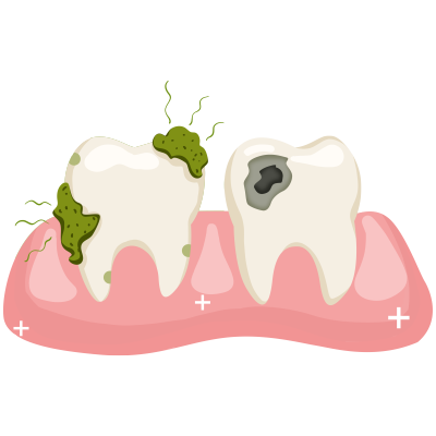 透明背景口腔内受伤的牙齿插画素材